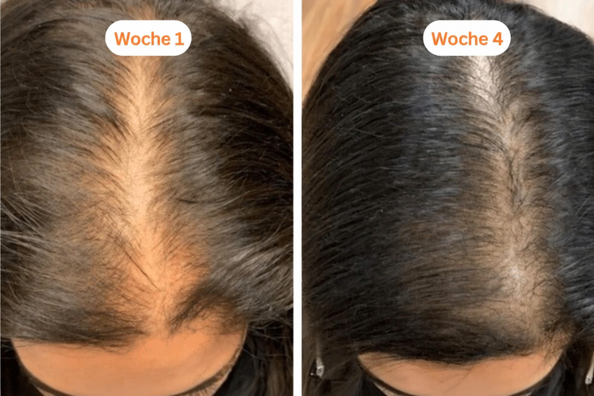 Foto der Haarentwicklung