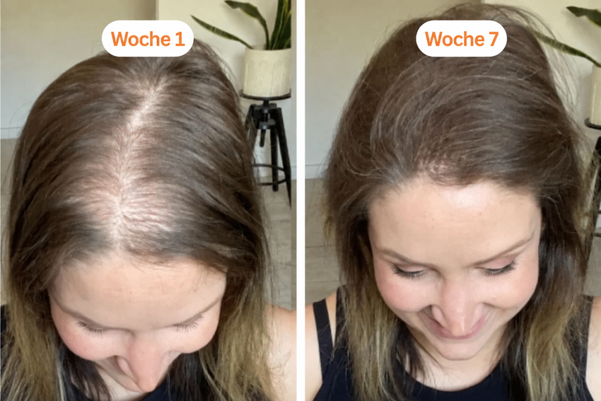 Foto der Haarentwicklung