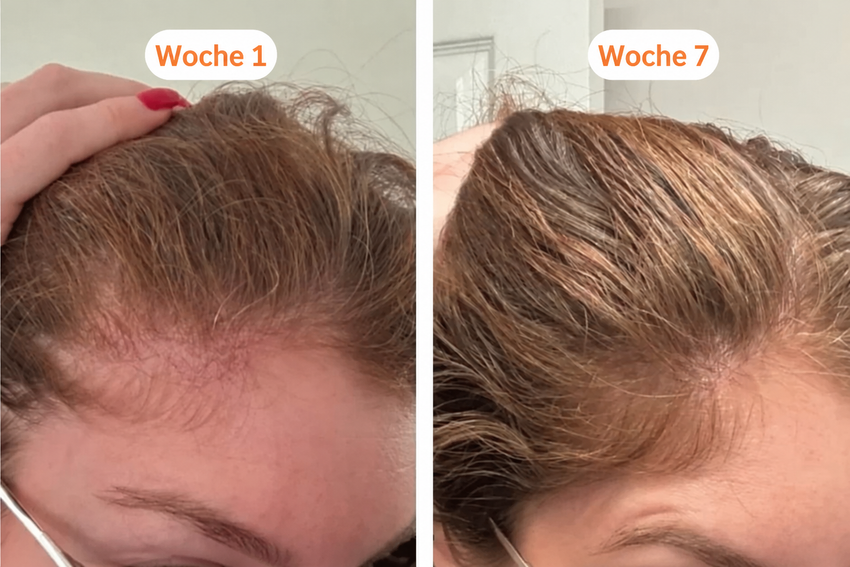 Foto der Haarentwicklung